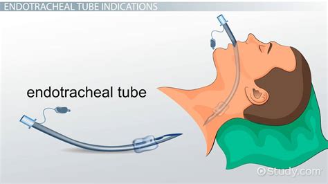 eut tube|EUT .